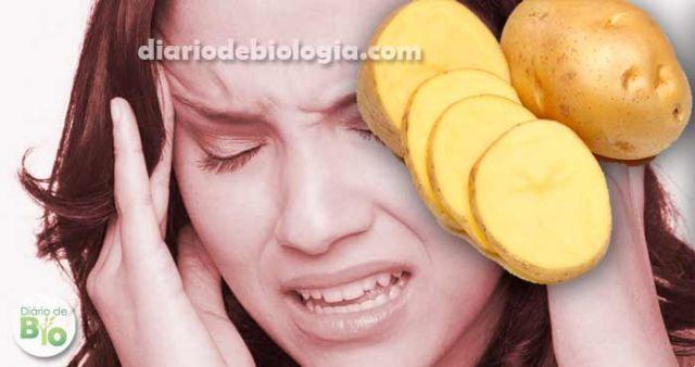 Patatas para los dolores de cabeza: ¿realmente funcionan?